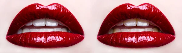 Labios rojos dobles, blanqueamiento dental antes y después —  Fotos de Stock