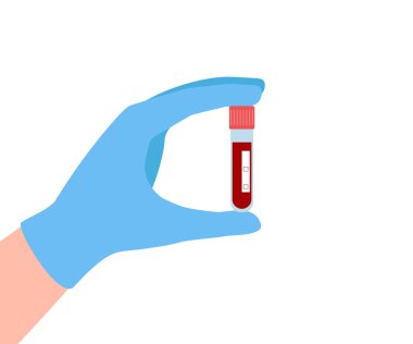 Eldivende kan olan test tüpü. Virüs analizi. Vektör illüstrasyonu