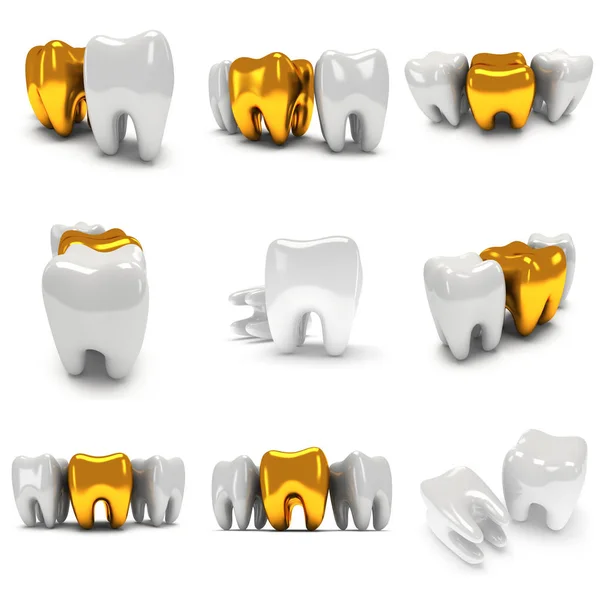 Gold and healthy teeth — Stock Photo, Image