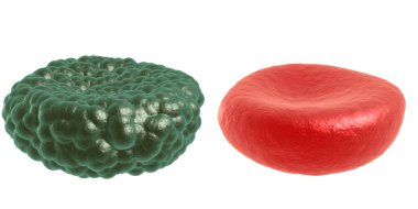 Yeşil hastalık ve kırmızı kan hücresi