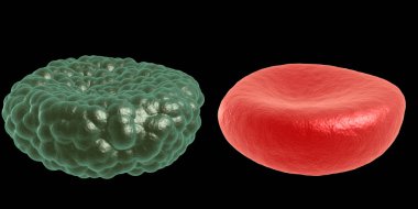 Yeşil hastalık ve kırmızı kan hücresi