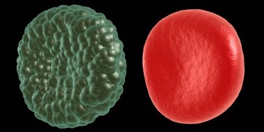 Yeşil hastalık ve kırmızı kan hücresi