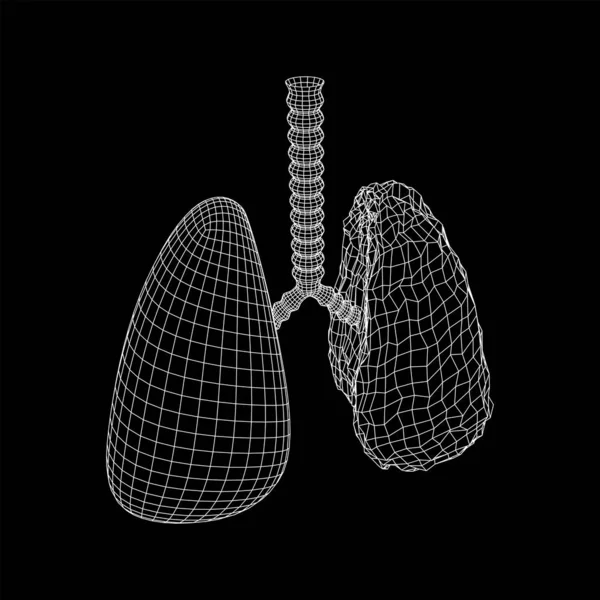Легені з трахеєю бронхів внутрішній орган людини — стоковий вектор
