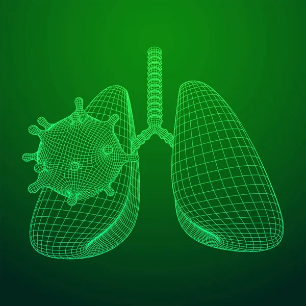 Coronavirus Und Lungen Mit Luftröhrenbronchien Internes Organ Mensch Covid Virus — Stockvektor