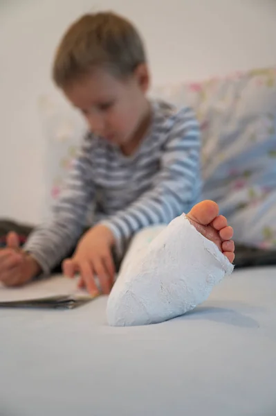 Niño pequeño con la pierna rota en un yeso . — Foto de Stock