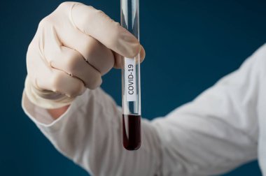 Hastaların kanlarıyla dolu cam bir test tüpü tutan bir tıp doktorunun eli ölümcül ve bulaşıcı Corona virüsü için test edilecek..