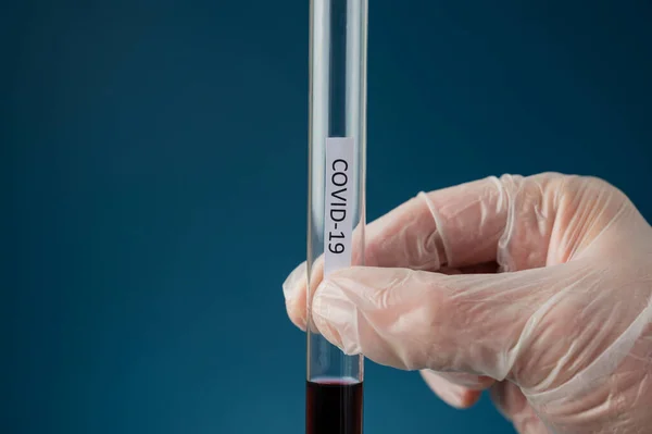 Hand Doctor Wearing Protecting Glove Holding Glass Test Tube Blood — Stock Photo, Image