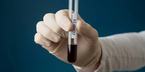 Pendekatan Dokter Memegang Tabung Kaca Dengan Darah Dengan Tanda Covid — Stok Foto