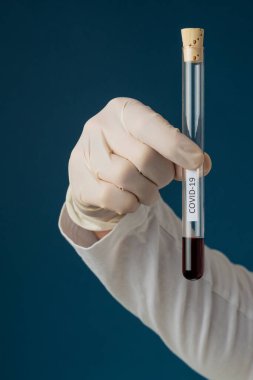 Yeni Covid 19 koronavirüs için kan örneği test ediliyor. Doktor elinde kanla test tüpü tutuyor. Mavi arkaplan.