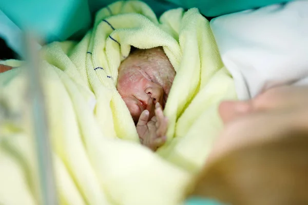 Madre buscando primero ime su bebé que nace vía cesárea — Foto de Stock