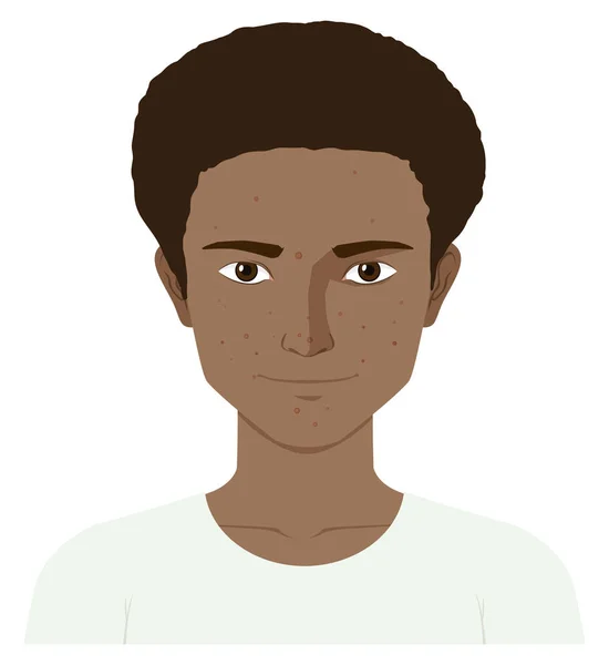 Мальчик-подросток с кожей — стоковый вектор