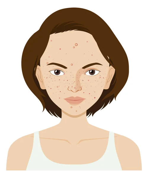 Mujer con problemas en la piel facial — Vector de stock