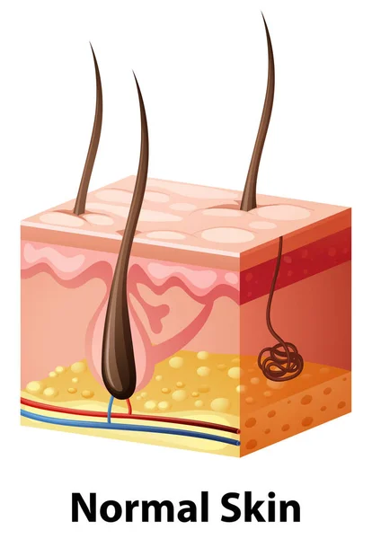 Diagramme montrant une peau normale — Image vectorielle