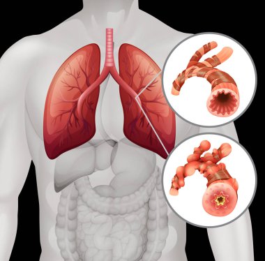 İnsan anatomisi ile yakın gemi