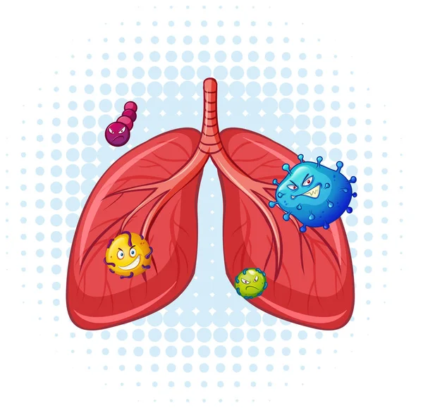 ウイルスと人間の肺 — ストックベクタ