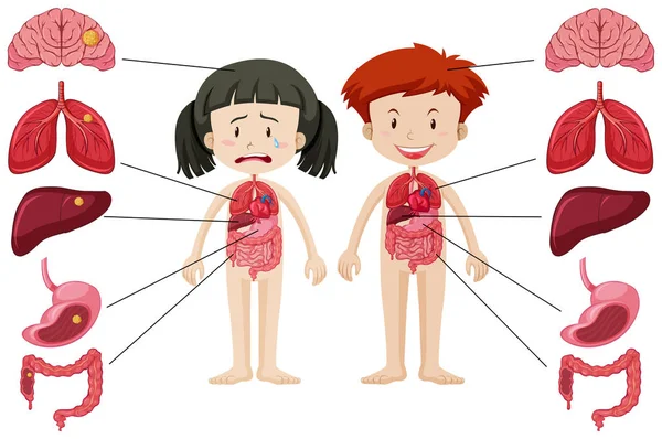 Fille et garçon avec un corps différent sain et malsain — Image vectorielle