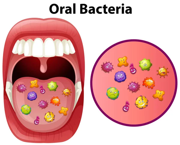 Oral bakteri gösteren bir resim — Stok Vektör