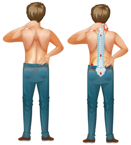 Hombre humano con dolor de espalda — Vector de stock
