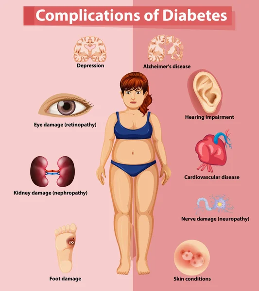 Complication of diabetes on poster — Stock Vector