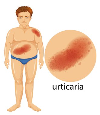 Ürtizi olan adamı gösteren diyagram