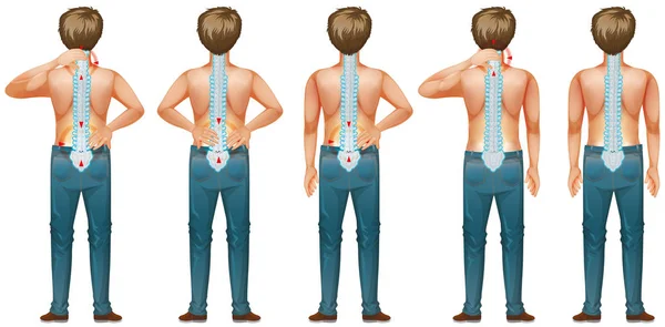Diagrama que muestra al hombre humano con dolor de espalda — Vector de stock