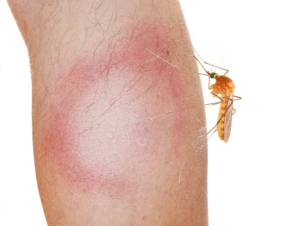 Mosquito and An Erythema Migrans rash. — Stock Photo, Image