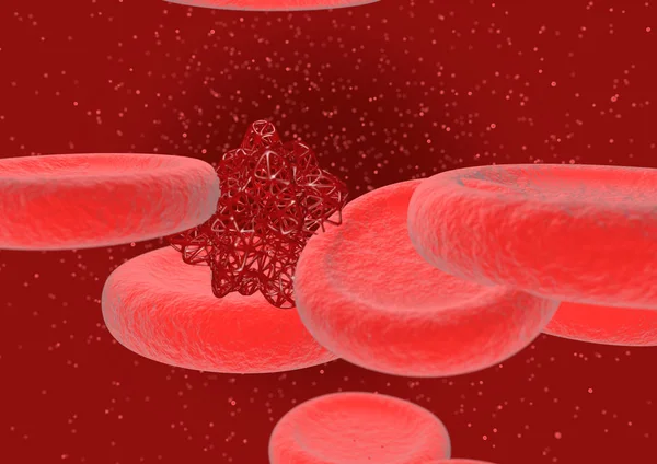 Células sanguíneas com infecção — Fotografia de Stock