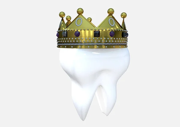 Dente com coroa 3D render — Fotografia de Stock
