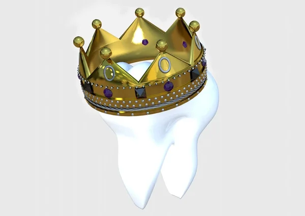 Zahn mit Krone 3d Render — Stockfoto