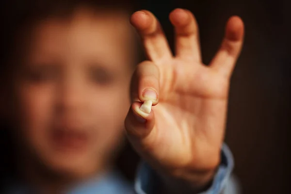 De Hand van de kinderen met een tand van de melk. Eerste tand verloren. — Stockfoto