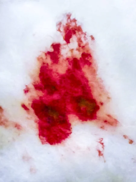 Blutfleck auf Baumwolle — Stockfoto