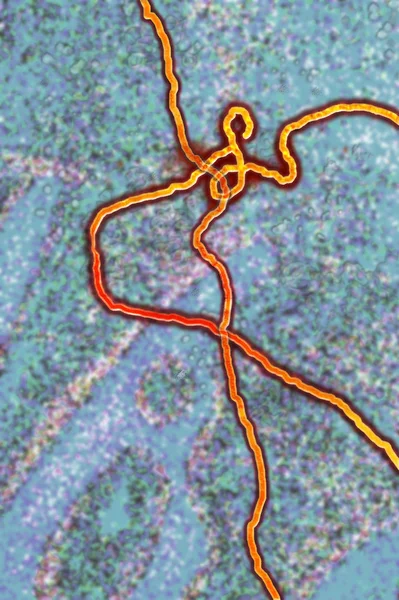 Ebola virüsü çizimi — Stok fotoğraf