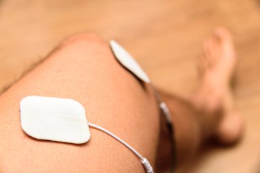 Bir erkek atletin bacağındaki elektrostimülatörün elektrotları..