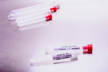 Kovid 19 'u tespit etmek için laboratuvar testi. Virüs bulaşmış hastaların bilgileriyle izole edilmiş test tüpleri..