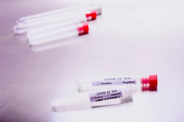 Laboratory Test Detect Covid Isolated Test Tubes Information Patients Infected — Stock Photo, Image