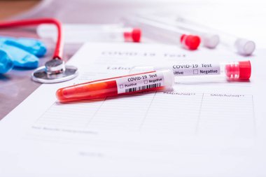 2020 'de Coronavirus enfeksiyonundan muzdarip olduğundan şüphelenilen hastaların kanıtlarını analiz etmek için.