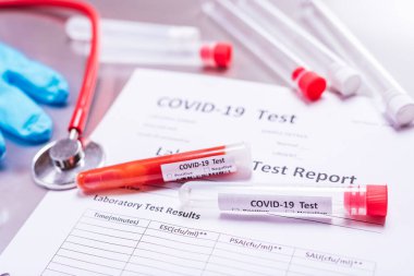 Bilimadamları virüsün yol açtığı covid hastalığının tedavisini laboratuvarlarda test ediyorlar..