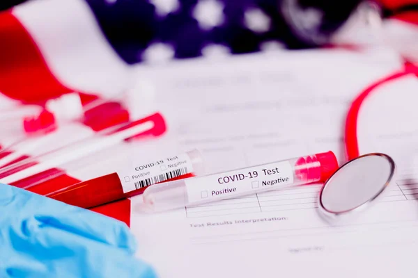 United States Threat Global Coronavirus Covid Pandemic Performs Thousands Tests — Stock Photo, Image