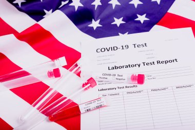 Birleşik Devletler küresel koronavirüs covid-19 salgını tehdidi altında hastalar üzerinde binlerce test yapar..