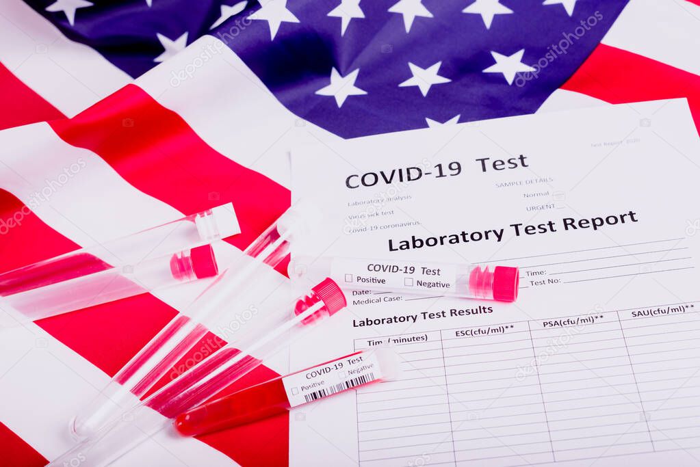 The United States under the threat of the global coronavirus covid-19 pandemic performs thousands of tests on patients.