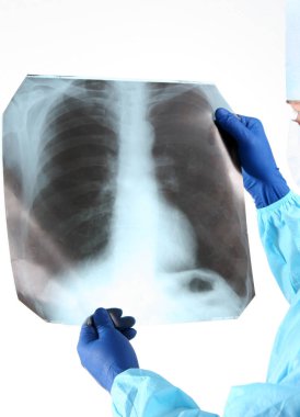 Doktor Röntgen tutan mavi üniformalı