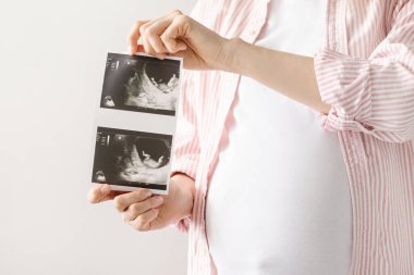 Ultrasonu olan hamile bir kadın parlak bir geçmişe sahip oluyor. Annelik, ilaç ve aşk öğesi