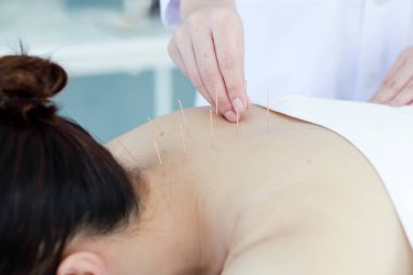Doktorun eli akupunktur terapisi yapıyor. Asyalı kadın ve