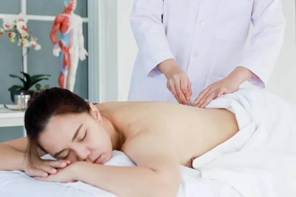 hand of doctor performing acupuncture therapy . Asian female und