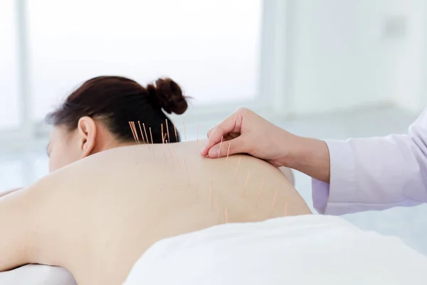Main du médecin effectuant un traitement d'acupuncture. asiatique femelle und — Photo