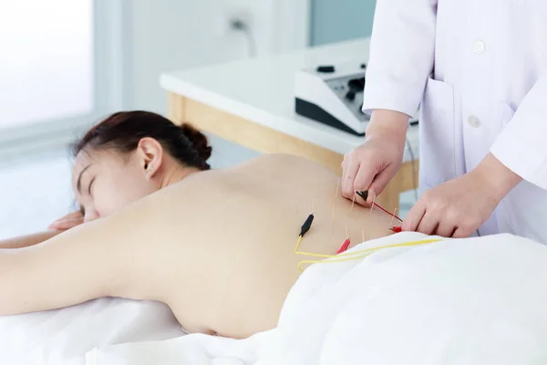 Hand of doctor performing acupuncture therapy . Asian female und — Stock Photo, Image