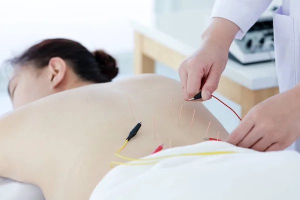 Doktorun eli akupunktur terapisi yapıyor. Asyalı kadın ve — Stok fotoğraf