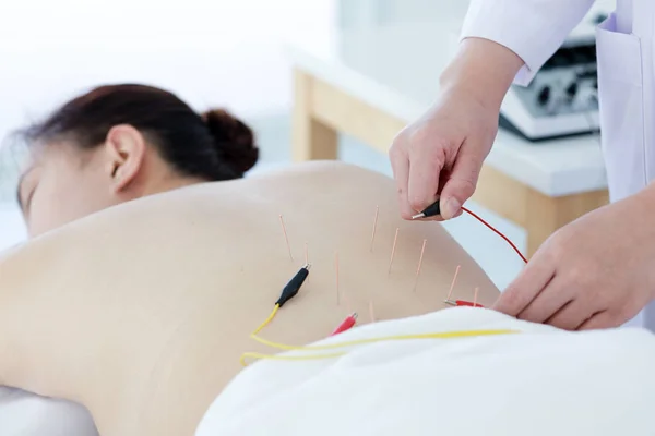 Hand des Arztes, der Akupunkturtherapie durchführt. asiatische Hündin und — Stockfoto