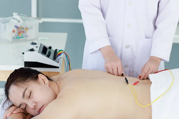 Mano del médico que realiza la terapia de acupuntura. Asiática mujer und — Foto de Stock