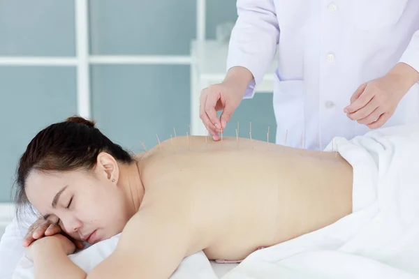 鍼治療を行う医師の手。アジアの女性と ロイヤリティフリーのストック写真